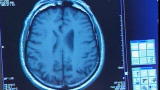Need to Know on the Go: Brain and Sex