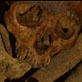 Bone Detectives: Missing Skull