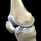 Body Invaders: Arthritis: Arthritis Test