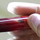 Mystery Diagnosis: The Girl Who Couldn't Eat