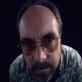 What Are the Odds?: Baldness