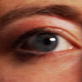 Mystery Diagnosis: Donor Disaster