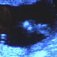 Ultimate Guide to Pregnancy: Month Four