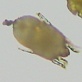 Body Invaders: Allergies: Dust Mites