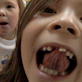 Jon & Kate Plus 8: Missing Teeth