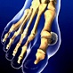 Body Invaders: Arthritis: Gout