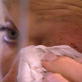Living with the Wolfman: Scratch on the Eye
