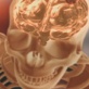 Surgery Saved My Life: Awake Craniotomy
