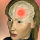Body Invaders: Headache: Causes