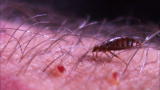 Monsters Inside Me: Bedbugs Feed on Arm