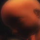 Ultimate Guide to Pregnancy: Month Six