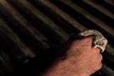 I Was Bitten: Bitten by a Rattler