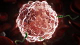Monsters Inside Me: The Flesh-Eating Parasite