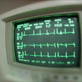 Aspirin Therapy: CME: Aspirin Therapy Part 3