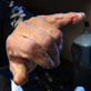 Deadliest Catch: Capt. Keith's Take: Lenny's Finger