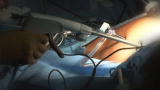 Colorectal Surgery: Colorectal Surgery Part 3