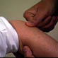 Fibromyalgia: Fibromyalgia Part 4