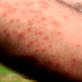 News: Proof Bug Repellant Works