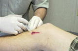 Greensburg: Webisode 6: Shane Gets Stiches