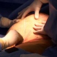Plastic Surgery: Before & After: Breast Reduction