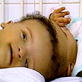 Baby Week: Egyptian Conjoined Twins, Part 1